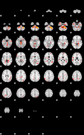 Patient:29;component:135