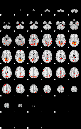 Patient:29;component:136