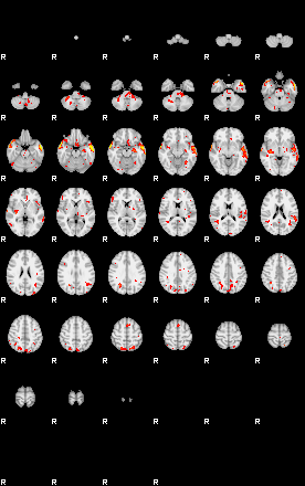 Patient:29;component:137