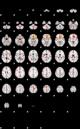 Patient:29;component:144