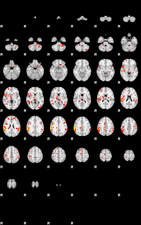 Patient:29;component:150