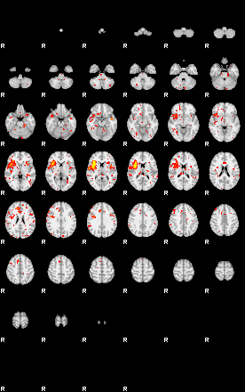 Patient:29;component:151