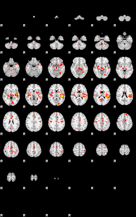 Patient:29;component:158