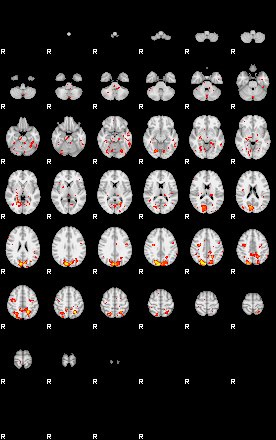 Patient:29;component:161