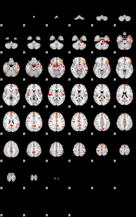 Patient:29;component:164