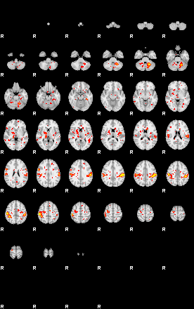 Patient:29;component:169