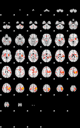 Patient:29;component:21