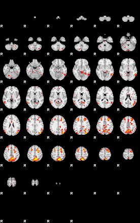 Patient:29;component:23