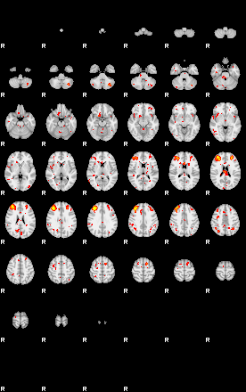 Patient:29;component:25