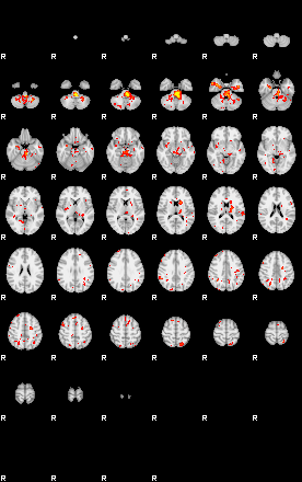 Patient:29;component:32