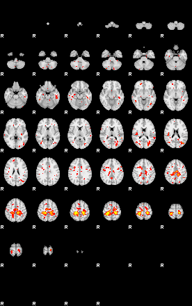 Patient:29;component:37