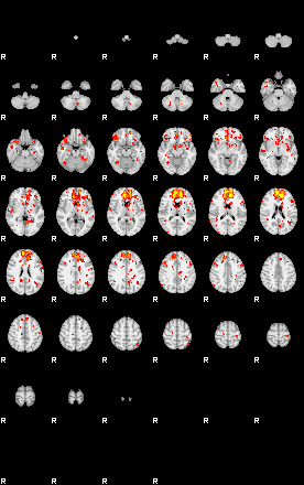 Patient:29;component:44