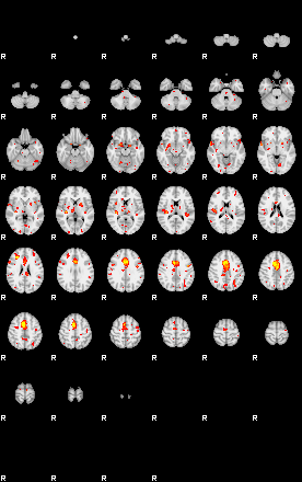 Patient:29;component:46