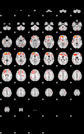 Patient:29;component:48