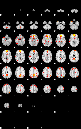 Patient:29;component:49