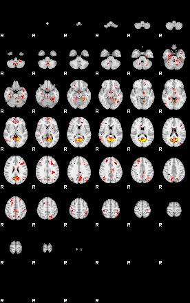 Patient:29;component:5