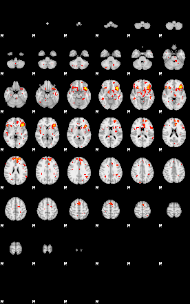 Patient:29;component:52