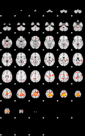 Patient:29;component:55