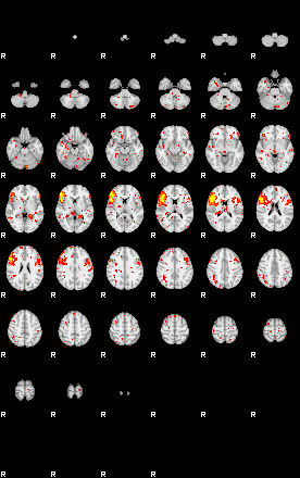 Patient:29;component:6