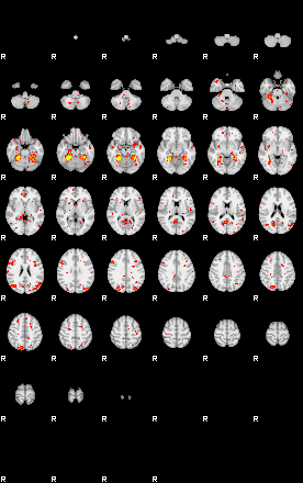 Patient:29;component:82