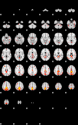 Patient:29;component:84