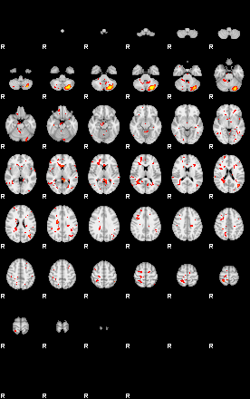 Patient:29;component:93