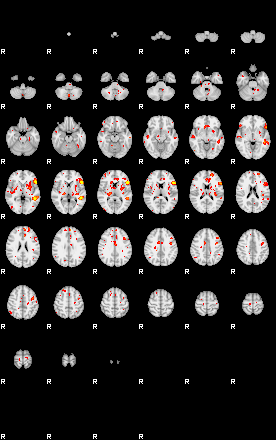 Patient:29;component:94