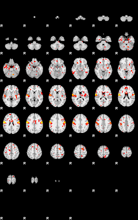 Patient:29;component:96