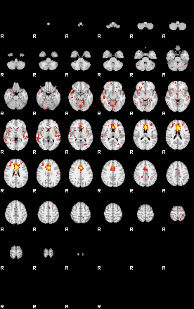 Patient:30;component:125