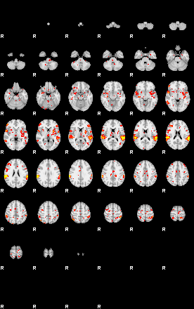 Patient:30;component:150