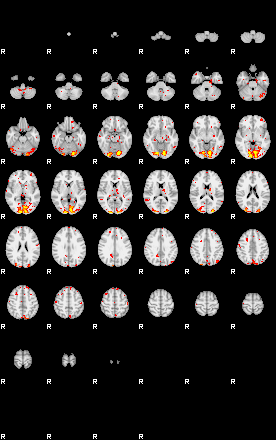 Patient:30;component:171