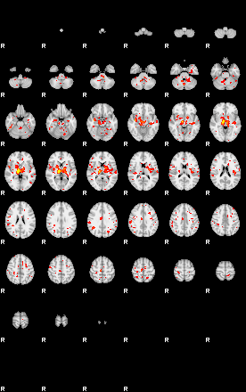 Patient:30;component:175