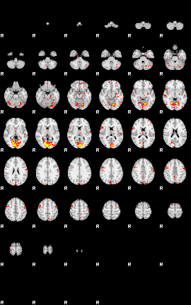 Patient:30;component:191