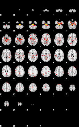 Patient:30;component:32