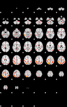 Patient:30;component:34