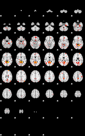 Patient:30;component:5