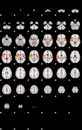 Patient:30;component:58