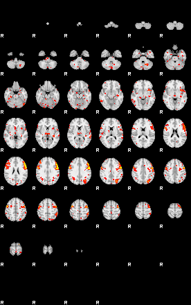 Patient:30;component:60