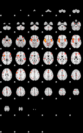 Patient:30;component:87