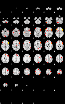 Patient:30;component:94