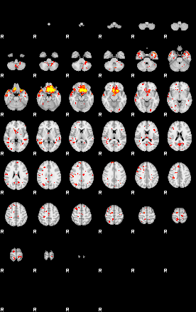 Patient:31;component:113