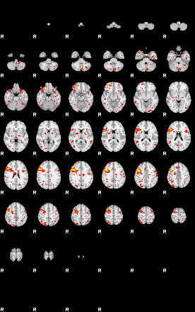 Patient:31;component:119