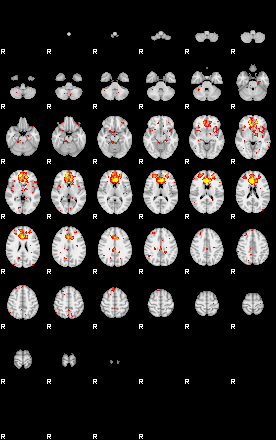 Patient:31;component:125