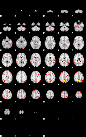 Patient:31;component:131