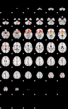 Patient:31;component:144