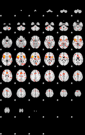 Patient:31;component:151