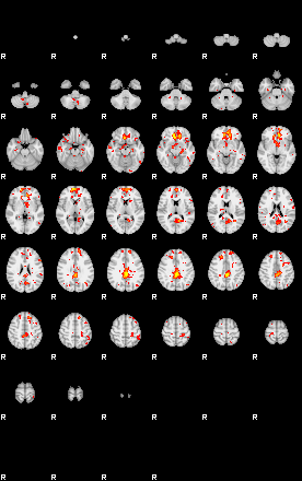 Patient:31;component:180