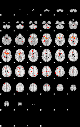 Patient:31;component:200