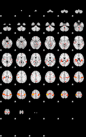 Patient:31;component:21