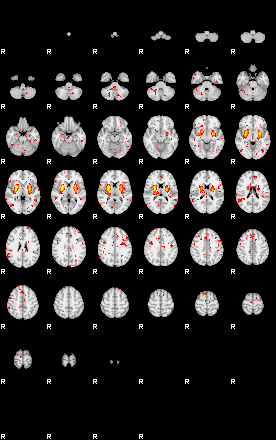 Patient:31;component:39